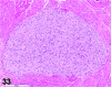 Figure 33