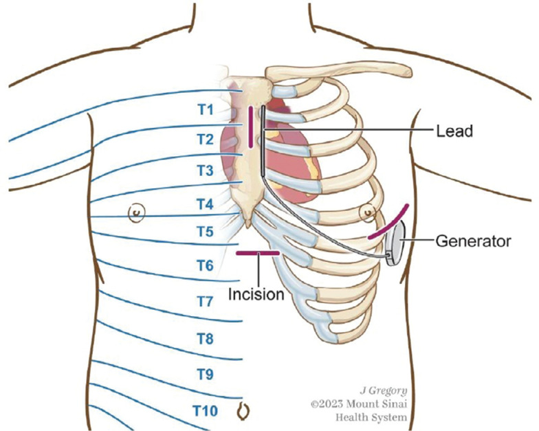 Figure 1: