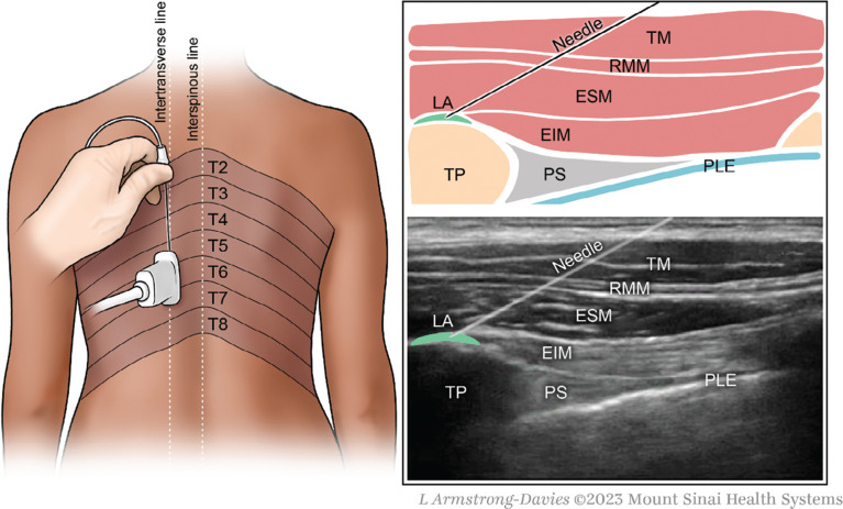 Figure 2: