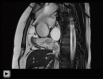 Video 2