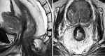 Fig. 13