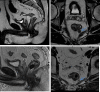 Fig. 11