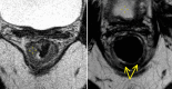 Fig. 12