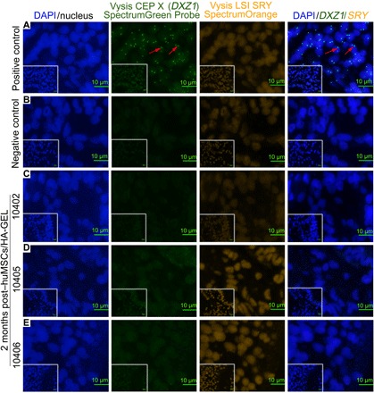 Fig. 5 FISH analysis for tracking transplanted huMSCs in the endometrium.