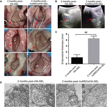 Fig. 3 The endometrial effects of different interventions on morphology and ultrastructure.