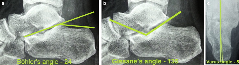 Fig. 4