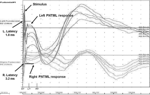 Figure 15