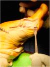 Fig. 4