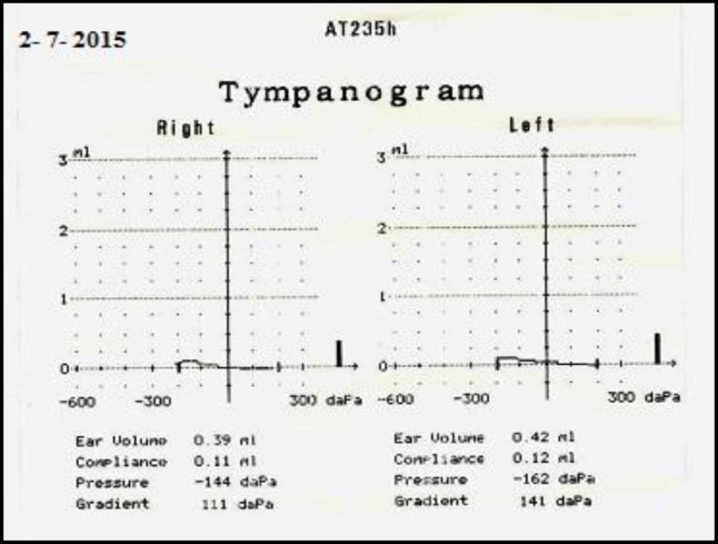 Fig 4