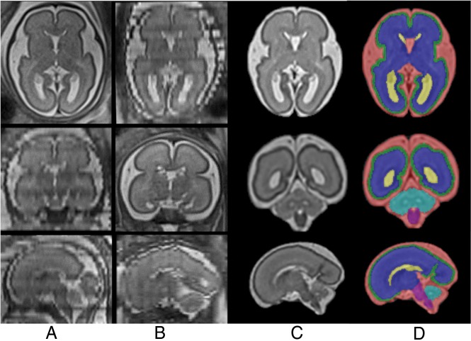 Fig 2.