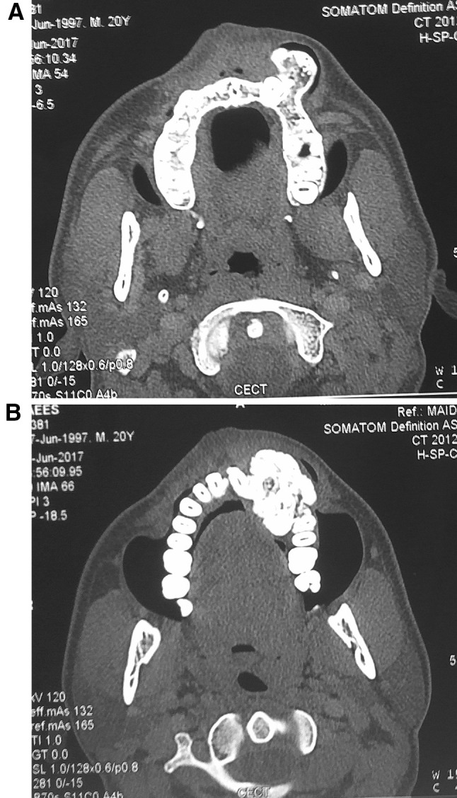 Fig. 5