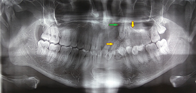 Fig. 4