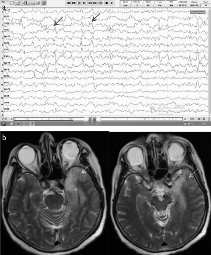 Figure 1. a, b.