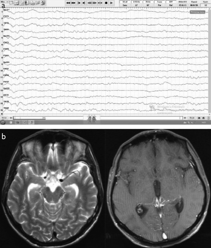 Figure 3. a, b.