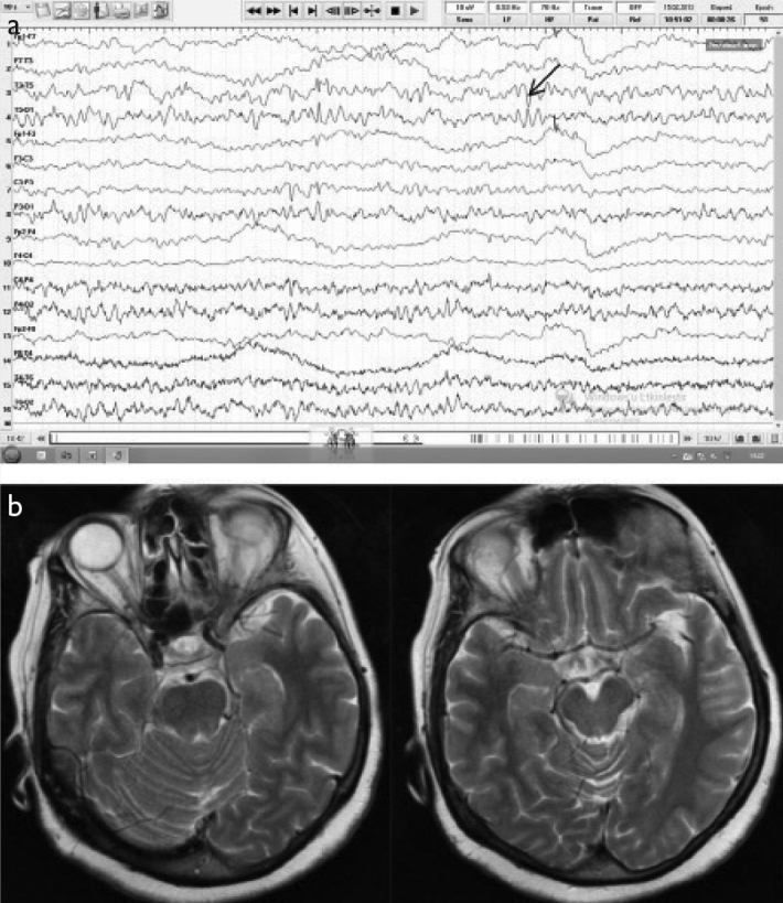 Figure 2. a, b.