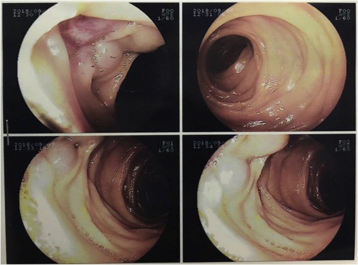 Fig. 2