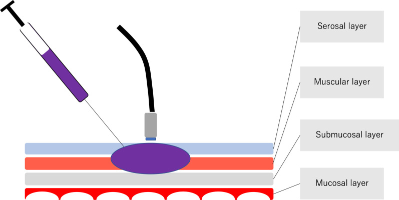 Fig. 1