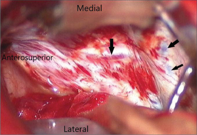 Figure 4: