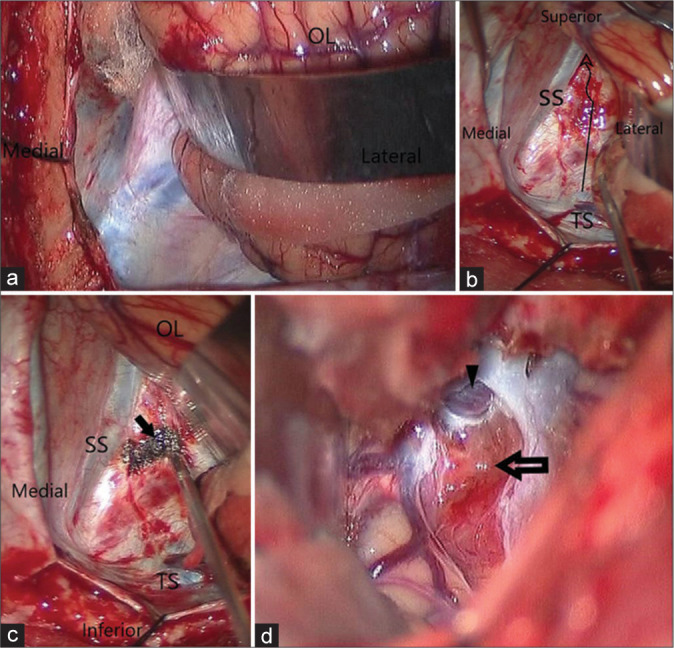 Figure 3: