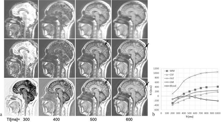 Fig 8.