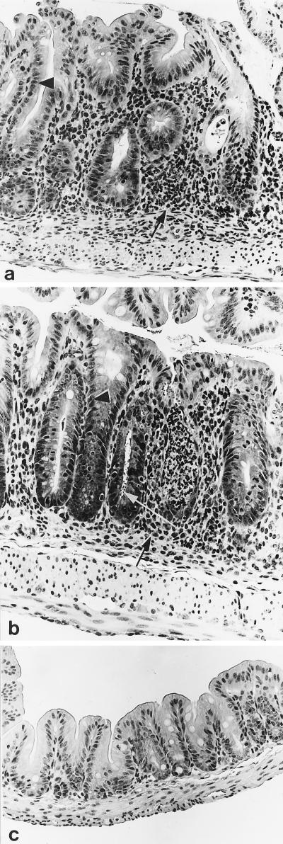 FIG. 1