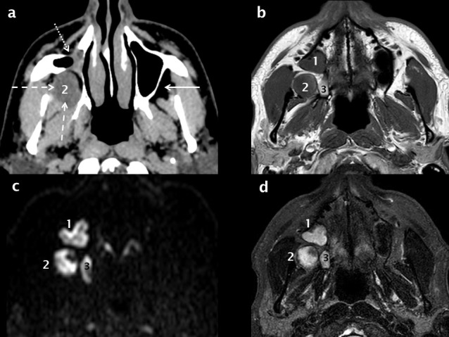 Figure 12.