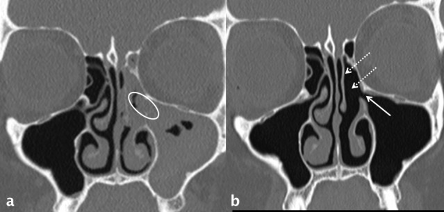 Figure 16.