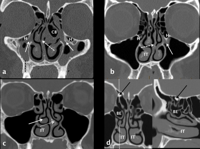 Figure 17.