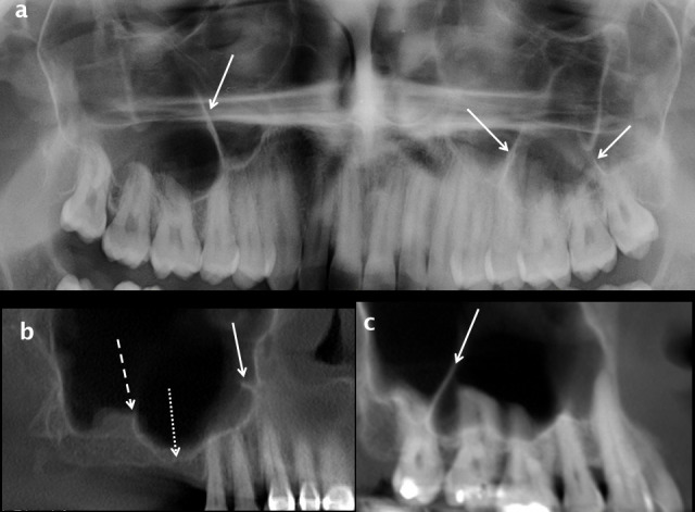 Figure 14.