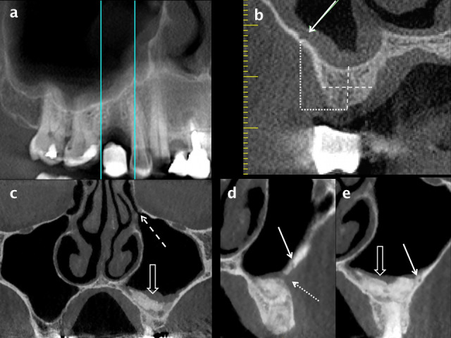 Figure 11.