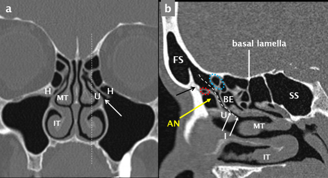 Figure 13.