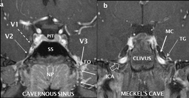 Figure 18.