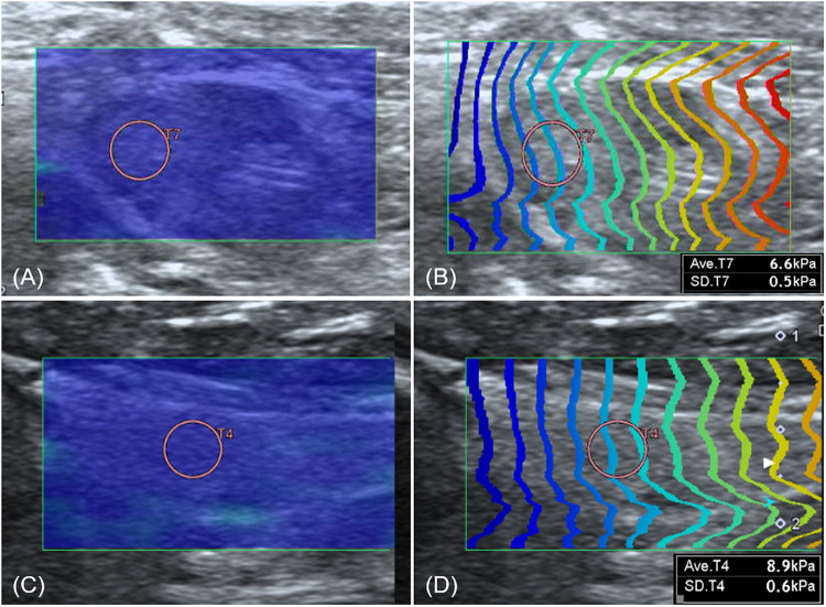 FIGURE 6