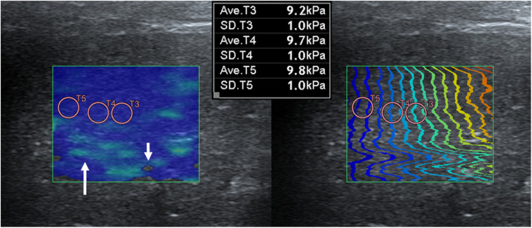 FIGURE 4