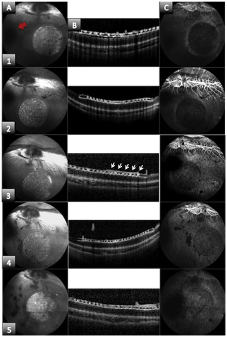 Figure 3: