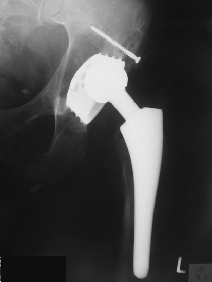 Fig. 1
