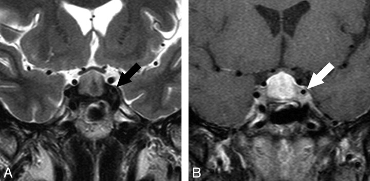 Fig 1.