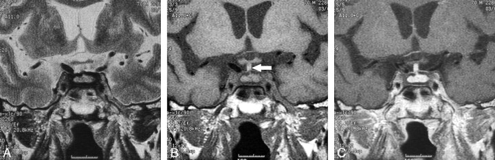 Fig 2.