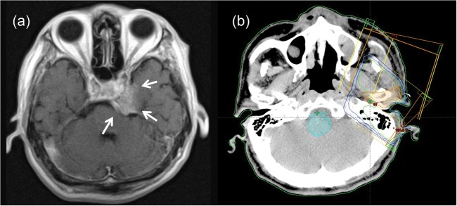 Fig. 3.