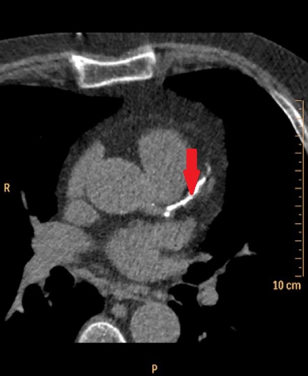 Fig. 2