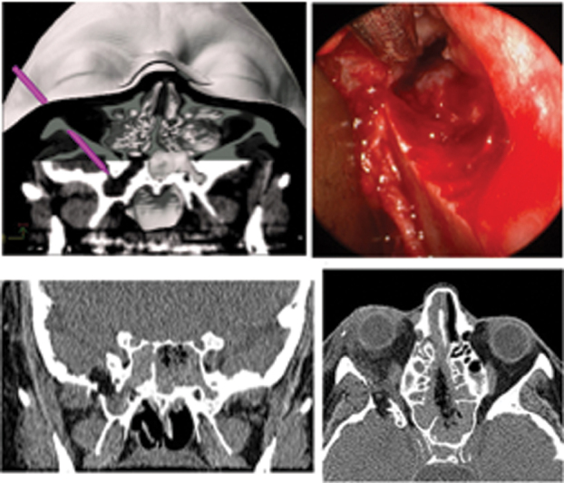 Fig. 10