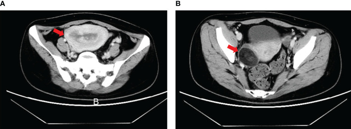 Figure 1