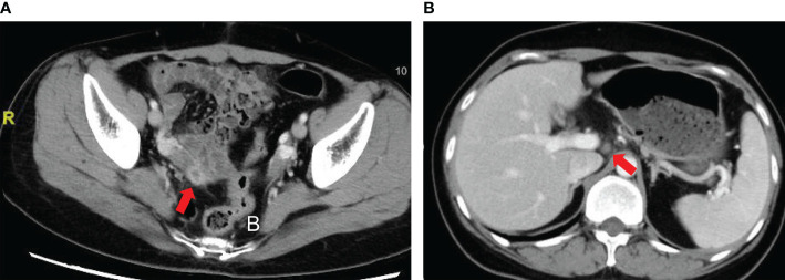 Figure 3