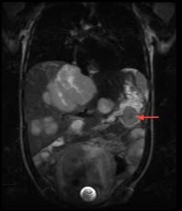 Fig 1b