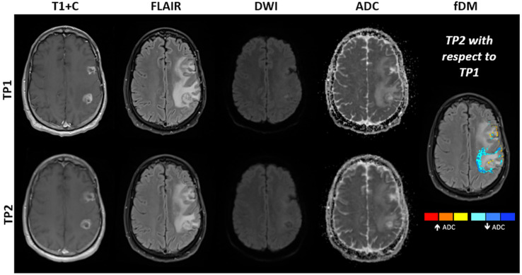 Figure 11