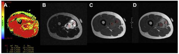 Figure 17