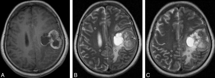 Fig 2.