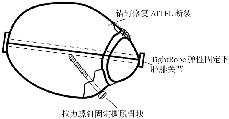 图 2