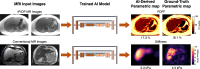 Solutions to site technology barrier: AI-derived liver fat and
stiffness measurements obtained from other sequences. Diagram shows examples
of AI-derived PDFF measurements from in-phase (IP) and out-of-phase (OP) MR
images (top row) and AI-derived stiffness measurements from conventional MR
images (T1- and T2-weighted MR images shown) (bottom row).