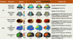 Quantitative imaging biomarkers for the MASLD spectrum. On the MR
elastographic images, the dashed white lines outline the liver.
Classification of “clinical” or
“investigational” reflects how these modalities are used at
the authors’ institutions.